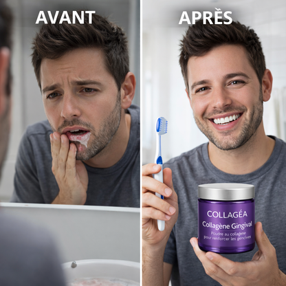 Collagéa™ I Poudre au collagène pour renforcer les gencives