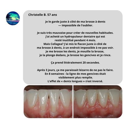 Collagéa™ I Poudre au collagène pour renforcer les gencives